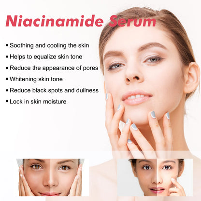 Hoygi Niacinamide Face – Serum – Brightening & Pore Refining Skin✨