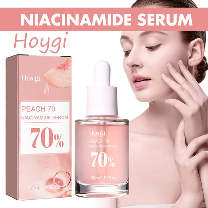 Hoygi Niacinamide Face – Serum – Brightening & Pore Refining Skin✨