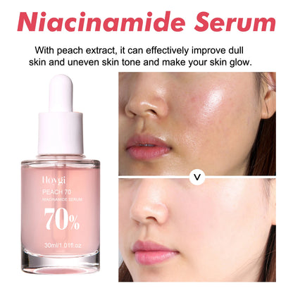 Hoygi Niacinamide Face – Serum – Brightening & Pore Refining Skin✨