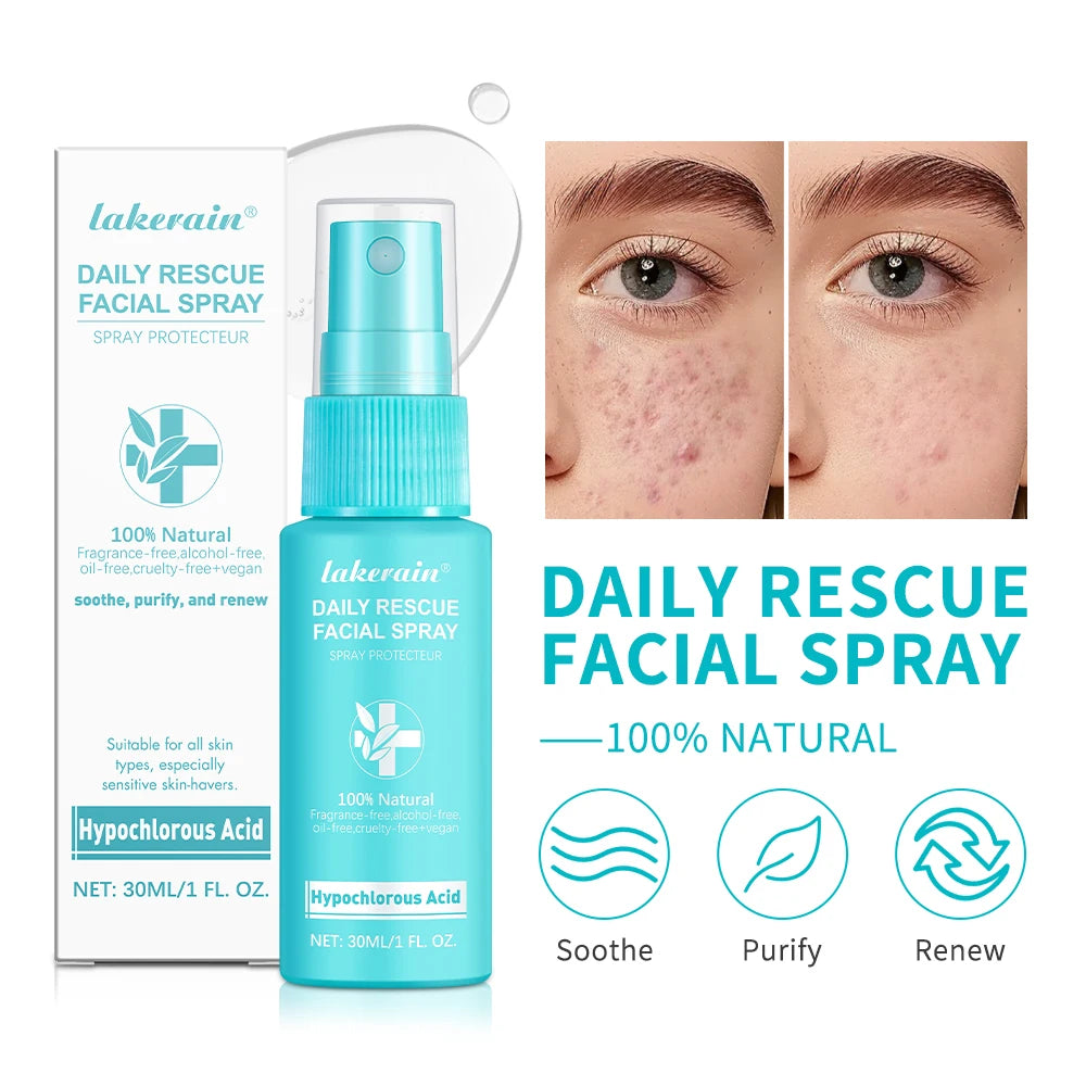 Ph Balancing Facial – Spray – Hypochlorous Acid Soothing Toner✨