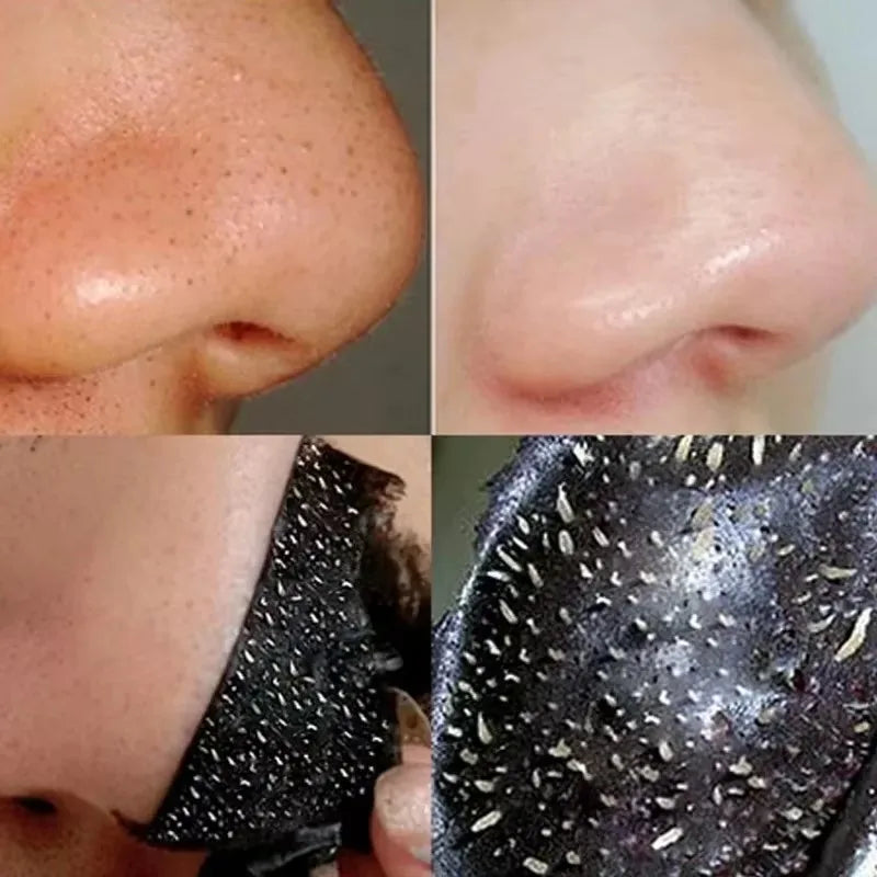 Bamboo Charcoal Blackhead – Remover Mask🖤✨