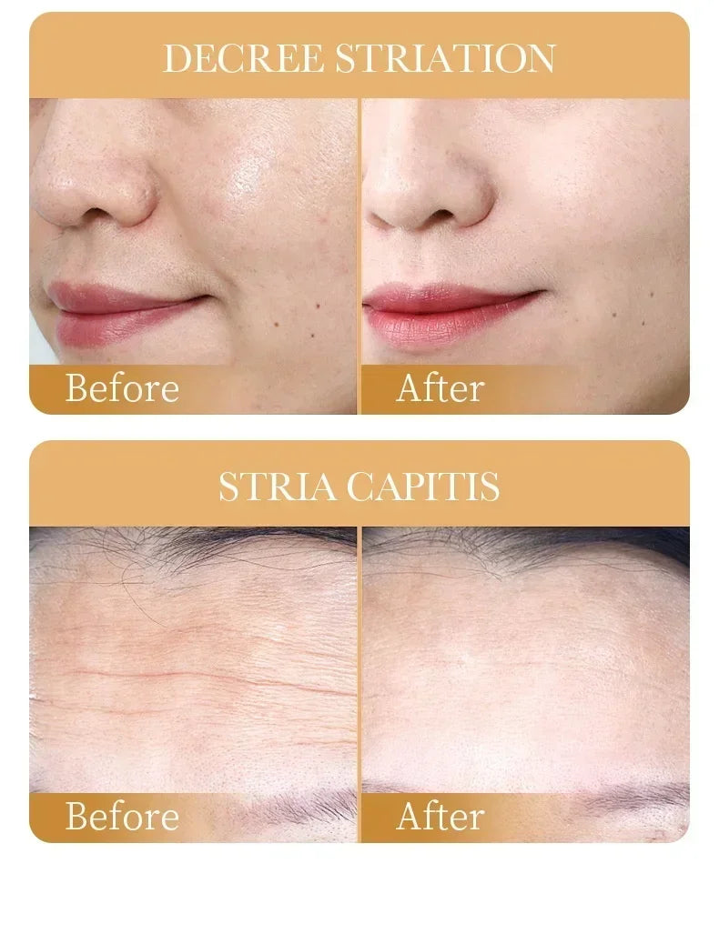 Sadoer - Collagen Face Mask (10Pcs)✨