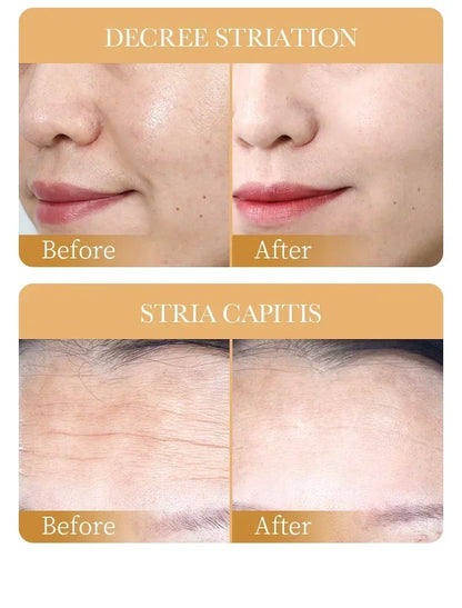 Sadoer - Collagen Face Mask (10Pcs)✨