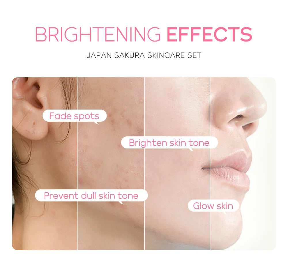 Laikou Vitamin C – Sakura Snail Skincare Set (3Pcs)✨🌸🐌