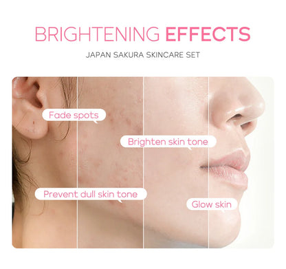 Laikou Vitamin C – Sakura Snail Skincare Set (3Pcs)✨🌸🐌