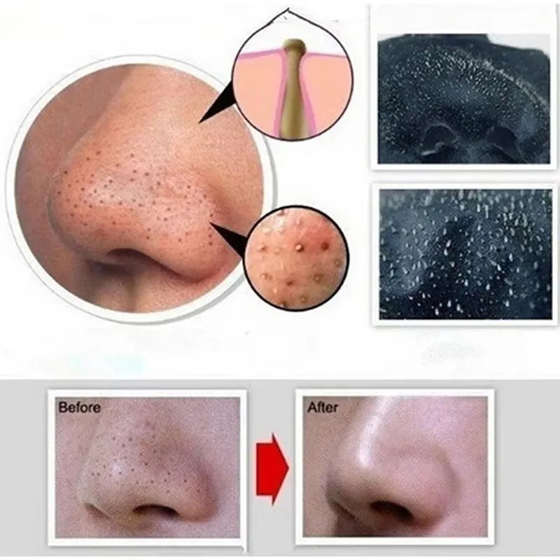 Bamboo Charcoal Blackhead – Remover Mask🖤✨