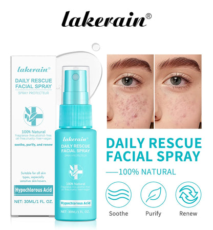 Ph Balancing Facial – Spray – Hypochlorous Acid Soothing Toner✨