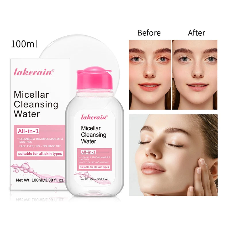 Mild Micellar Cleansing – Water – All-In-One Gentle Makeup Remover✨