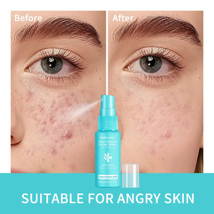 Ph Balancing Facial – Spray – Hypochlorous Acid Soothing Toner✨