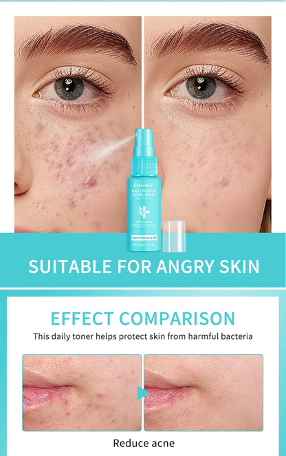 Ph Balancing Facial – Spray – Hypochlorous Acid Soothing Toner✨