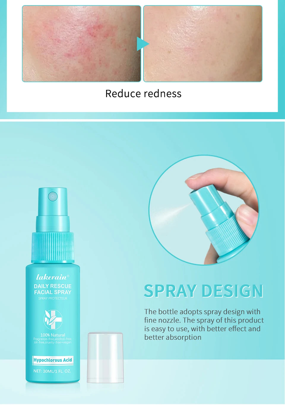 Ph Balancing Facial – Spray – Hypochlorous Acid Soothing Toner✨