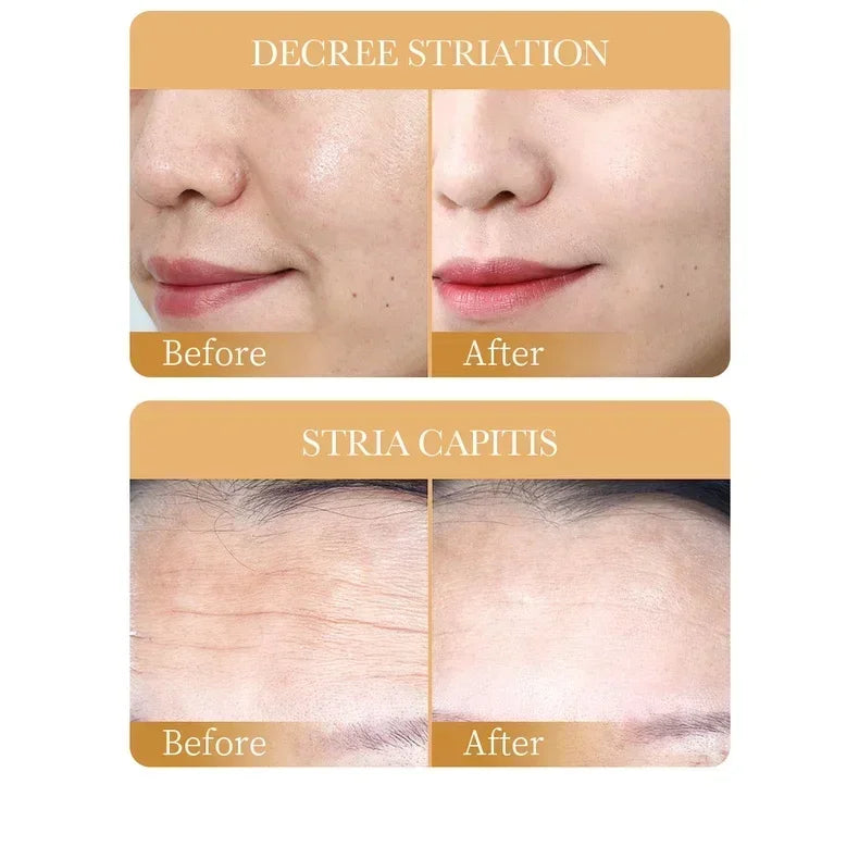 Sadoer - Collagen Face Mask (10Pcs)✨