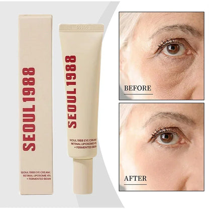 Seoul 1988 - Retinol Eye Cream 4%✨