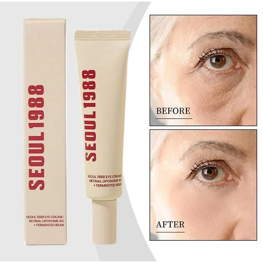 Seoul 1988 - Retinol Eye Cream 4%✨