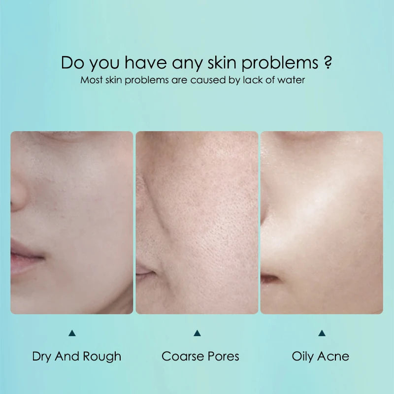 Hyaluronic Acid - Sheet Face Masks  (10pcs ) 💧✨
