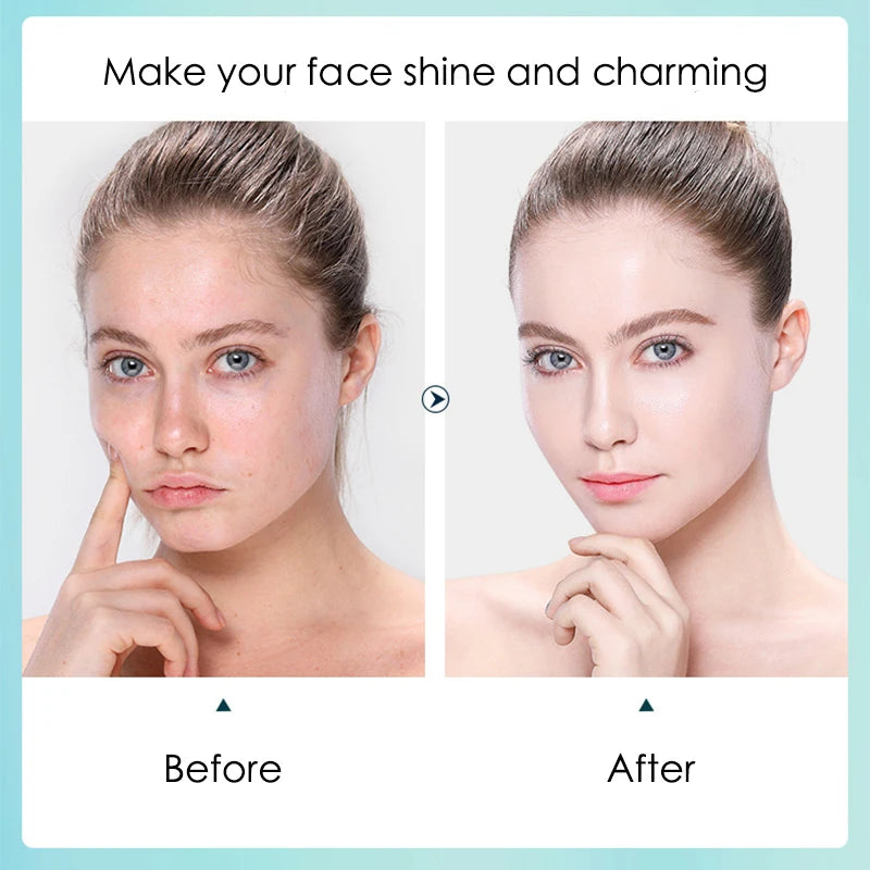 Hyaluronic Acid - Sheet Face Masks  (10pcs ) 💧✨