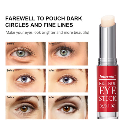 Retinol Anti-Wrinkle Eye Cream Stick✨