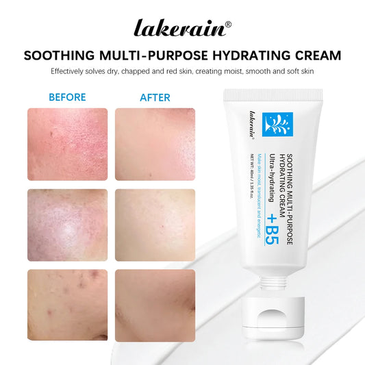 After-Sun Repair Cream – With Vitamin B5✨