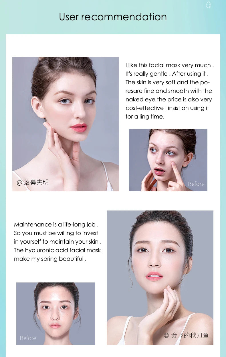 Hyaluronic Acid - Sheet Face Masks  (10pcs ) 💧✨