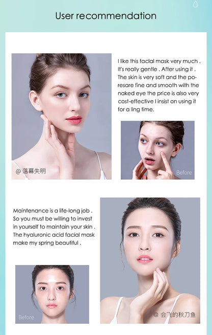 Hyaluronic Acid - Sheet Face Masks  (10pcs ) 💧✨