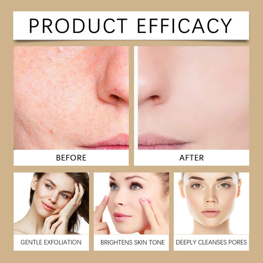 Hoygi Glow Rice Toner – Gentle Exfoliating & Hydrating Toner✨